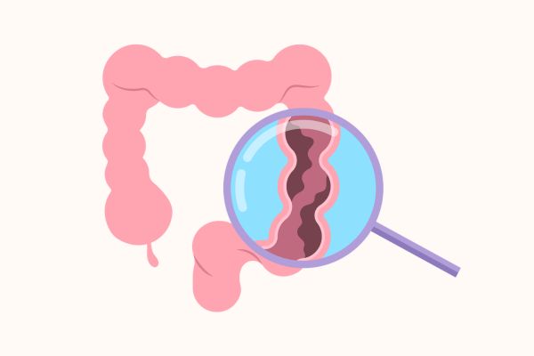 大腸のイメージイラスト