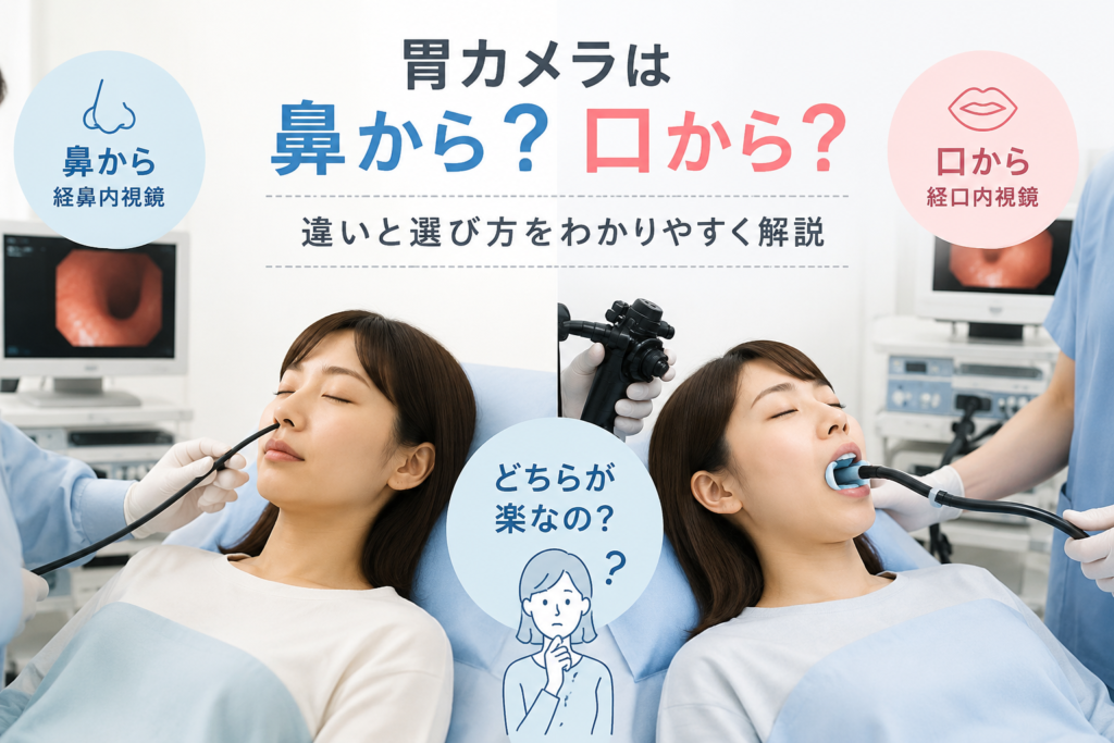 胃カメラは鼻から？口から？