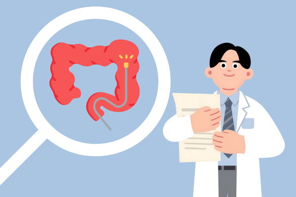 大腸カメラを少しでも楽に受ける方法